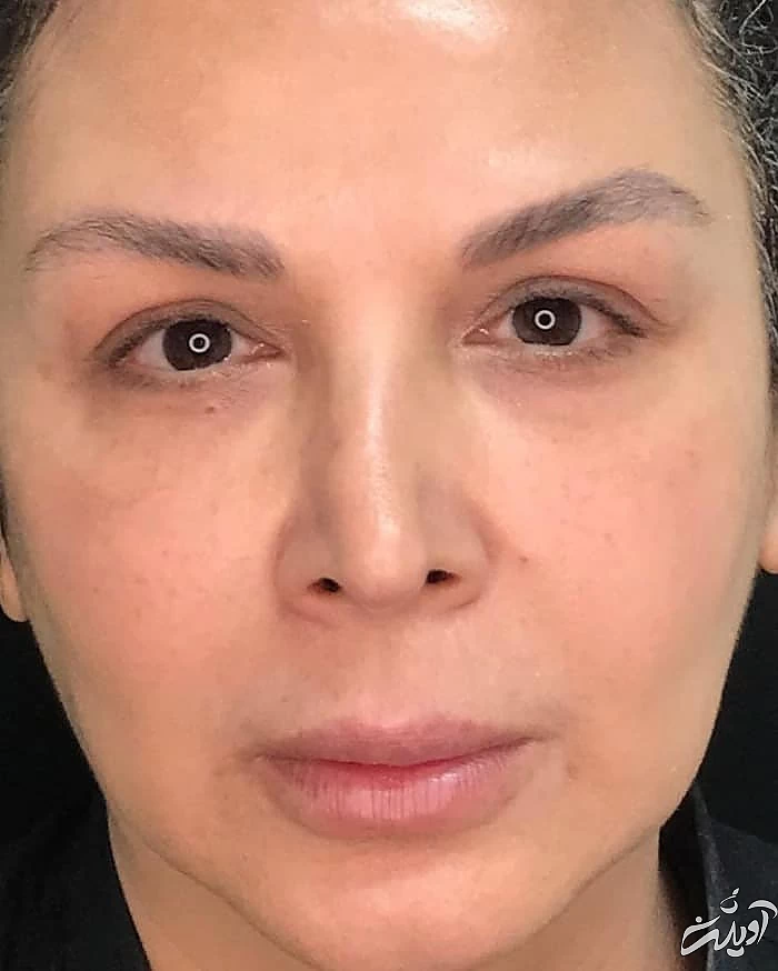 شهره سلطانی